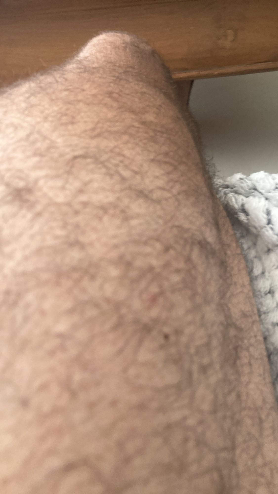 aucun aliment visible