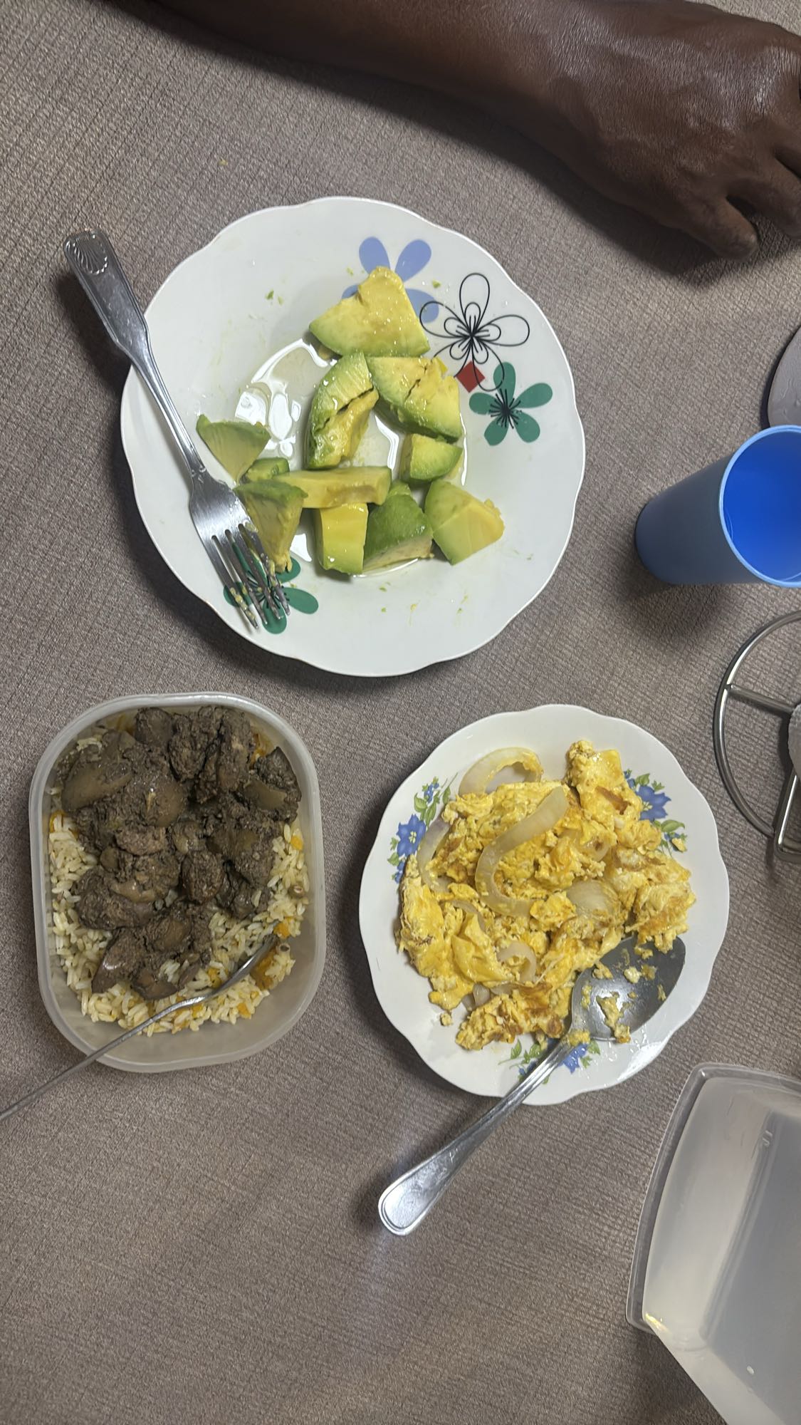 hígado con arroz, huevo y aguacate